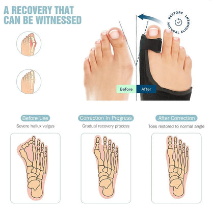 Foot Corrector System